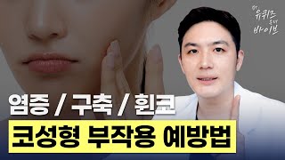 [Dr.유퀴즈온더바이브] 코 구축이 걱정된다면 꼭 봐야하는 코성형 부작용 진짜 원인과 예방법!