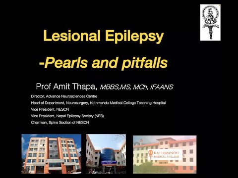 Prof Amit Thapa Speaks on Lesional Epilepsy
