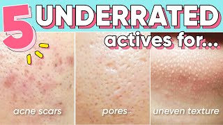 5 Ingredients You Need For Pores, Hyperpigmentation, Acne Marks 😏
