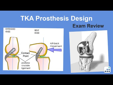 TKA Prosthesis Design Exam Review - Michael Bolognesi, MD