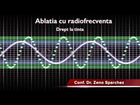 Hepatocarcinom Intalnire 8 Aprilie 2014
