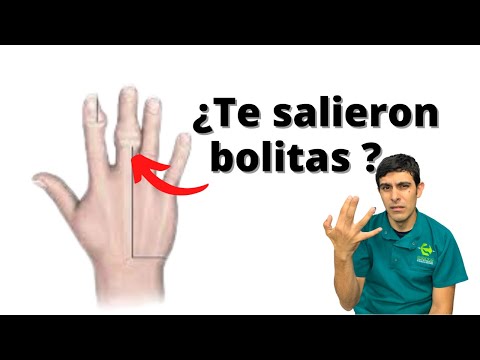 Ejercicios Para Los Nódulos En Los Dedos