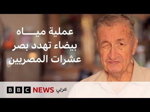 فيديو | كيف تحولت عملية مياه بيضاء بسيطة إلى كابوس يهدد بصر العشرات في مصر؟