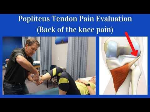 Popliteus Tendon Evaluation [Back of the knee pain]