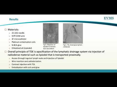 Thumbnail image of video presentation for Bronchoesophageal Fistula Diagnosed on Modified Barium Swallow, a Unique Presentation