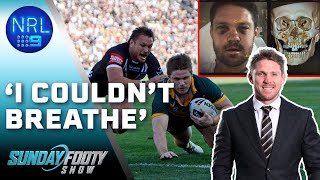 Tigers Legend recalls GRUESOME injury: Turn It Up - Sunday Footy Show | NRL on Nine