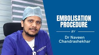 Embolization Procedure Best Explained By Dr. Naveen Chadrashekhar