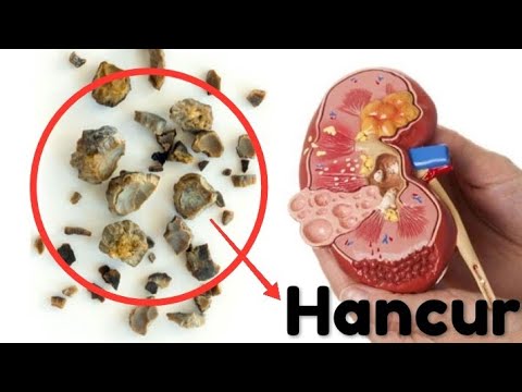 Bagaimana untuk memperbesar penis adalah Moskow Jahe untuk pria resep untuk potensi