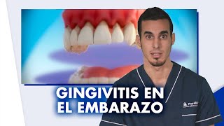 Inflamación de encías en el EMBARAZO - ¿Es normal | #Shorts