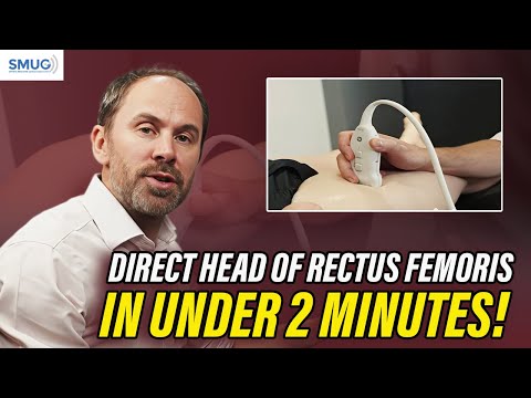 DIRECT HEAD OF RECTUS FEMORIS  - IN UNDER 2 MINUTES | Ultrasound of the Rectus Femoris