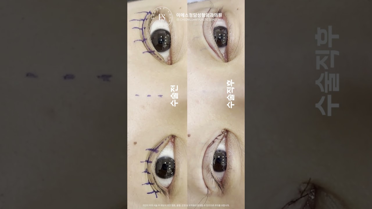 이에스 유튜브