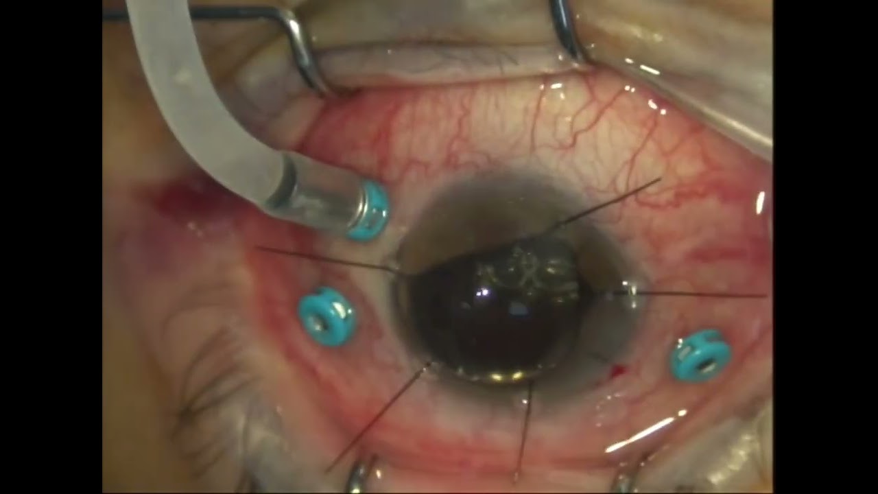 Juan Fernando Rivero Prado-11