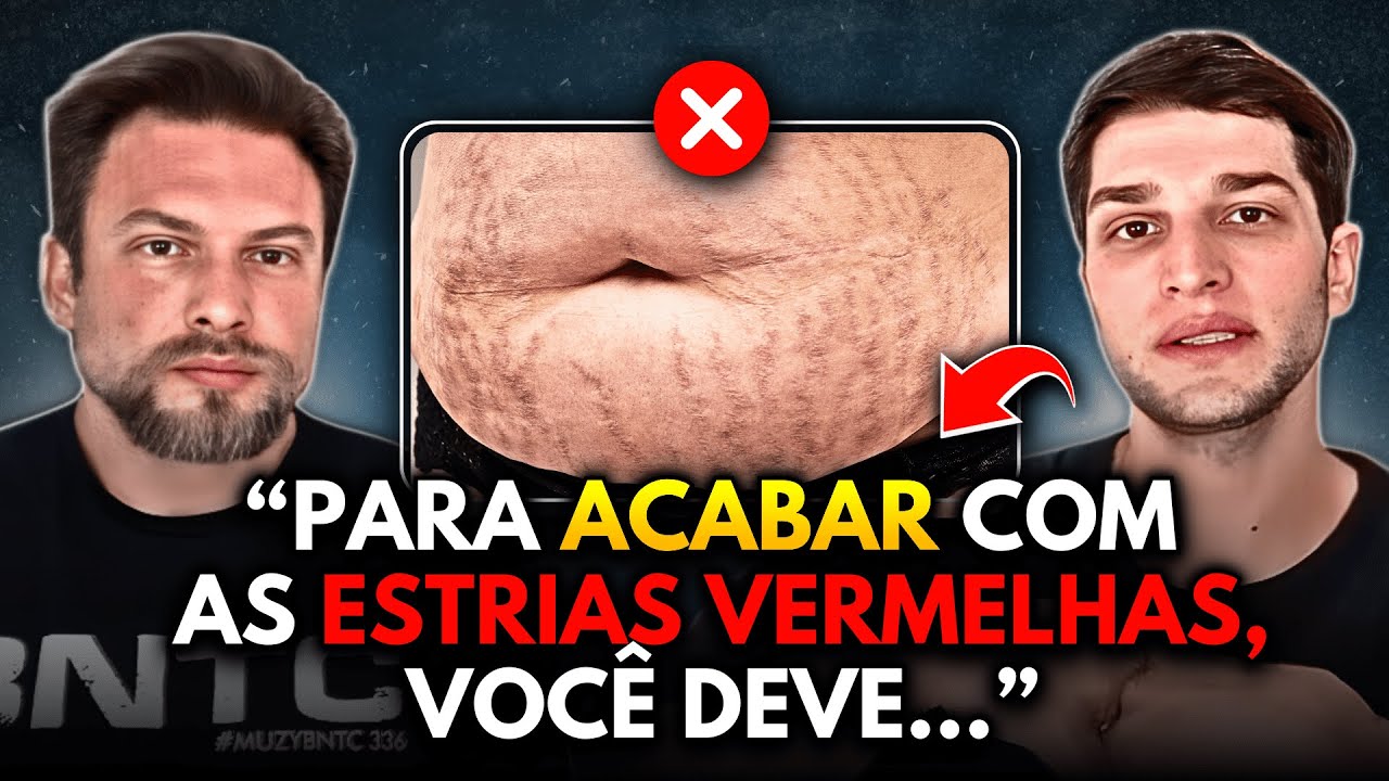 COMO SUMIR COM AS ESTRIAS VERMELHAS DE UMA VEZ? | Muzy Explica
