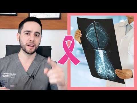 CÁNCER DE MAMA ETAPA TEMPRANA - Síntomas y Diagnóstico temprano - Cáncer in situ - Etapa 0