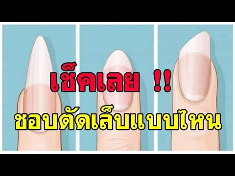 เตรียมเสริมสำหรับโรคสะเก็ดเงิน โปรแกรมทางการแพทย์สำหรับโรคสะเก็ดเงิน