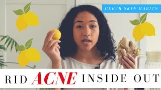 RID ACNE INSIDE OUT (QUICK EASY TIPS)