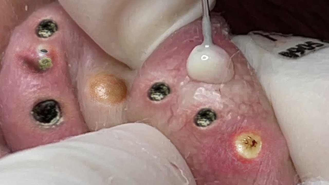 𝑨𝒄𝒉𝒊𝒆𝒗𝒆 𝑰𝒏𝒏𝒆𝒓 𝑷𝒆𝒂𝒄𝒆 𝑾𝒊𝒕𝒉 𝑻𝒉𝒆𝒔𝒆 𝑭𝒂𝒄𝒊𝒂𝒍 𝑪𝒍𝒆𝒂𝒏𝒔𝒊𝒏𝒈 𝑴𝒆𝒕𝒉𝒐𝒅𝒔 #9008345