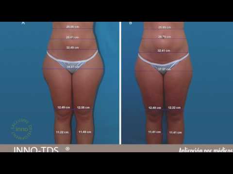 Diluted suka para sa pagbaba ng timbang Alisin cellulite sa pundamental na mga langis