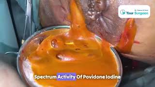 Download Lagu Very BIGGEST more than 1000 ml 🔥 PERIANAL ABSCESS TREATMENT u0026 SETON INSERTION in FISTULA IN ANO Thumbnail