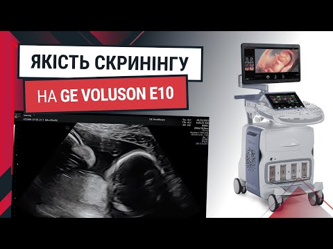 Деталізований скринінг GE Voluson E10 - Статті RH