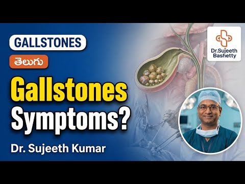 Gallstones Explained