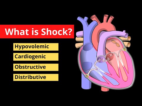 Shock Explained in 120 Seconds | Treatment, Symptoms, Causes | Video