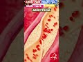 Yoga For Heart Heart Attack Yoga Yoga For Heart Disease Heart Problems Pawan Yoga