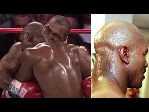 Why Would A Professional Fighter Bite Their Opponent?