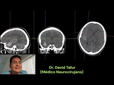 David Tafur Muñoz-3533