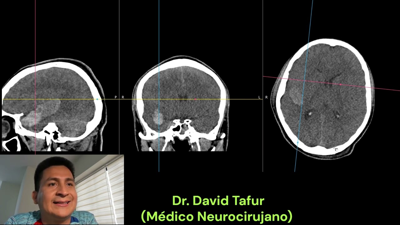 David Tafur Muñoz-2467