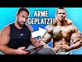 Kevin Wolter reagiert auf Synthol-Muskel-Monster spritzt sich Öl, bis er platzt! ( Arme amputiert )