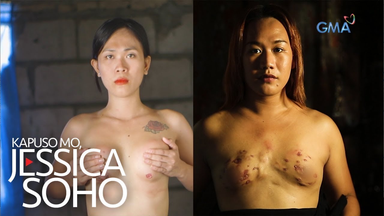 Kapuso Mo, Jessica Soho: Bagsak-presyong turok sa dibdib, nauwi sa disgrasya!