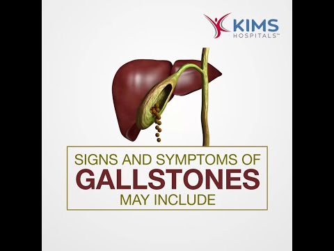 Signs and symptoms of gallstones may include