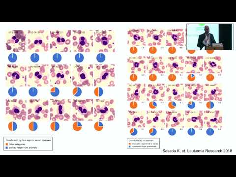 Role of Artificial Intelligence in Hematology and the Future of Medicine | Dr. Aziz Nazha(17Feb2024)