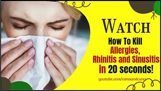 How To Cure Allergic Rhinitis Permanently| How To Get Rid Of A Stuffy Nose | Nasal Congestion