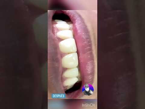 video 9anXWsEbBNk