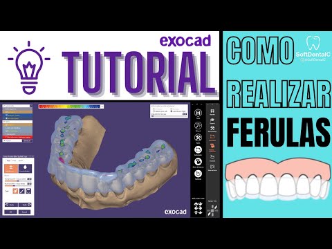 COMO REALIZAR FERULAS EN #EXOCAD 🔥¡TUTORIAL SOFTDENTALC!