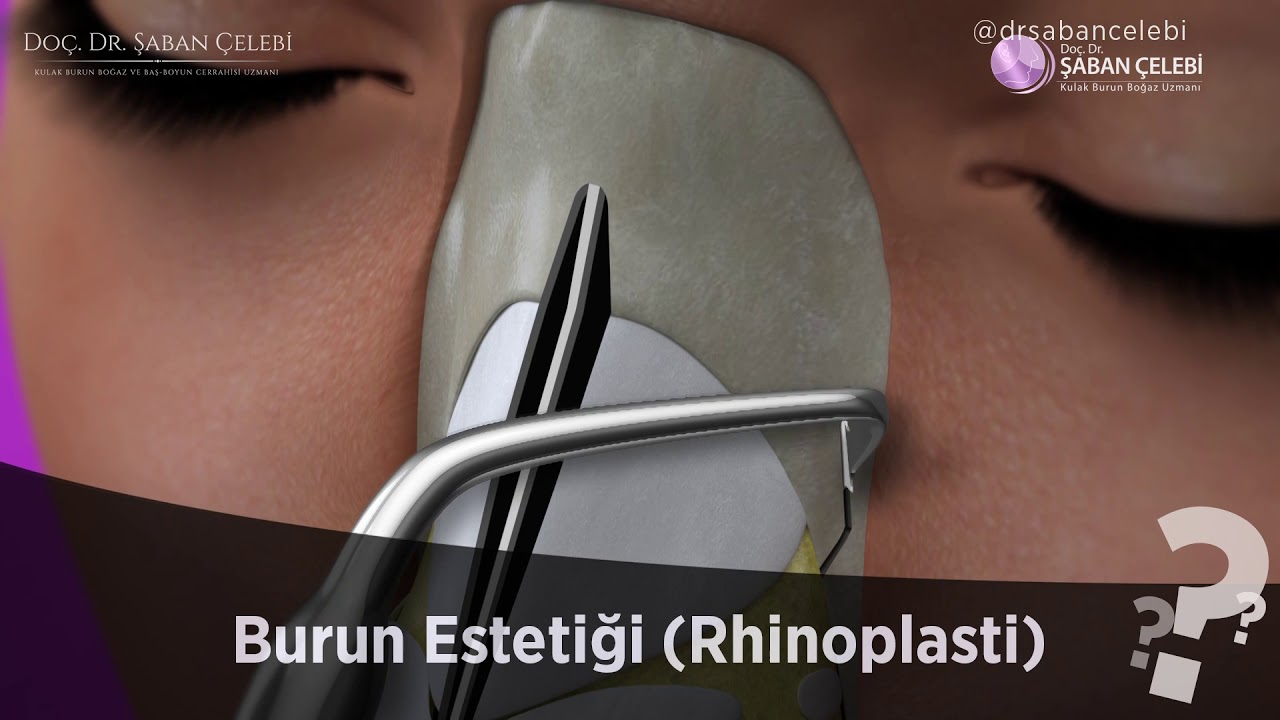 Burun estetiği (Rhinoplasti)