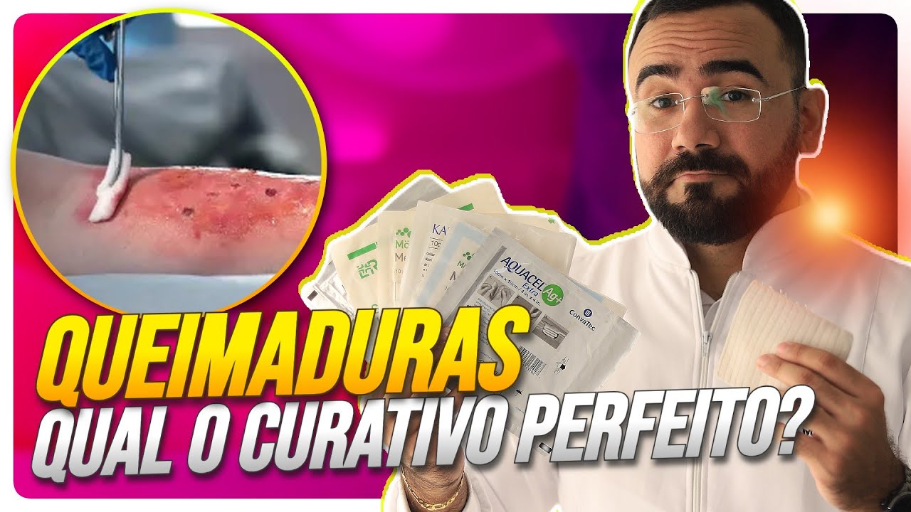 CURATIVO PERFEITO PARA QUEIMADURA, QUAL É? (APRENDA AGORA)