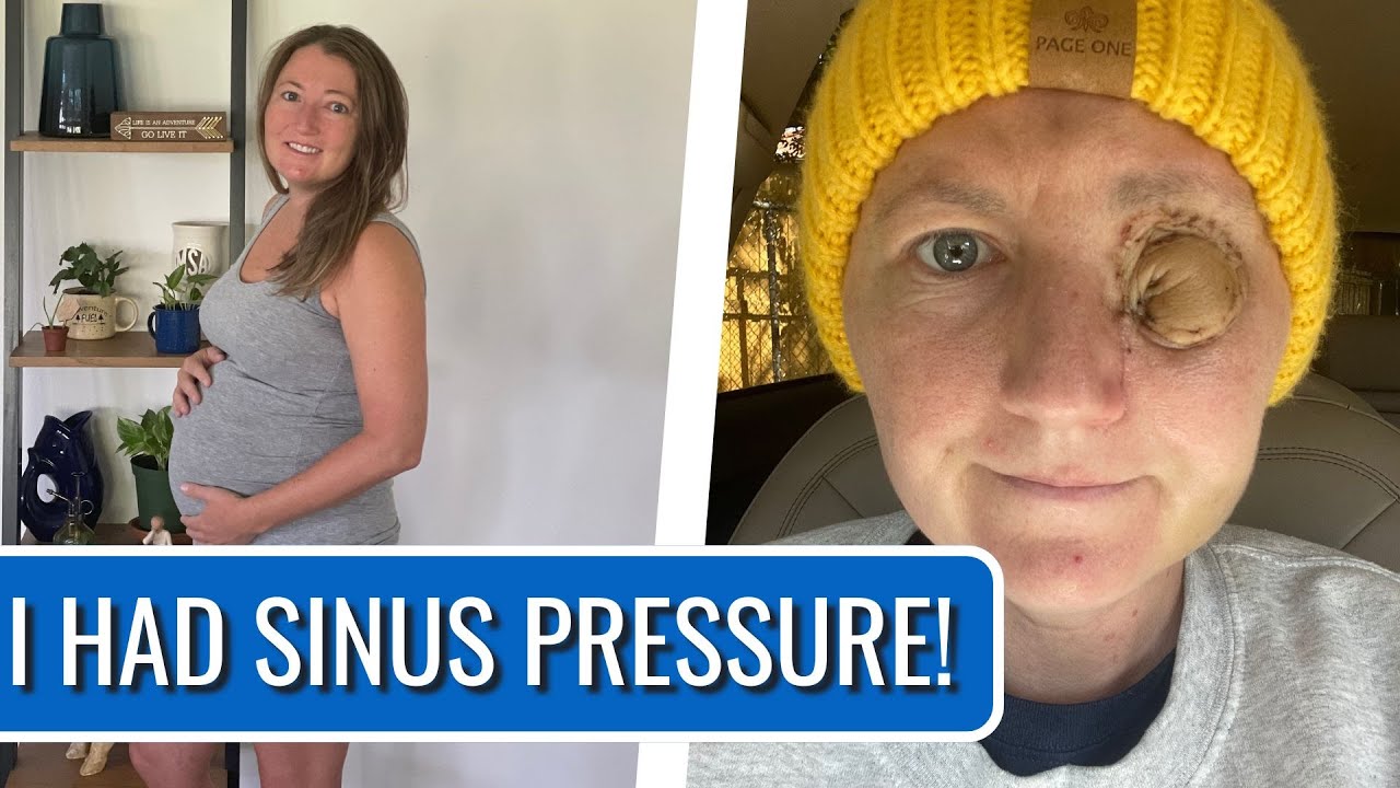 My Nosebleeds Were A WARNING Sign! - Melanie | Nasal Squamous Cell Carcinoma | The Patient Story