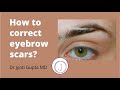 How To Fill In Scar On Eyebrow
