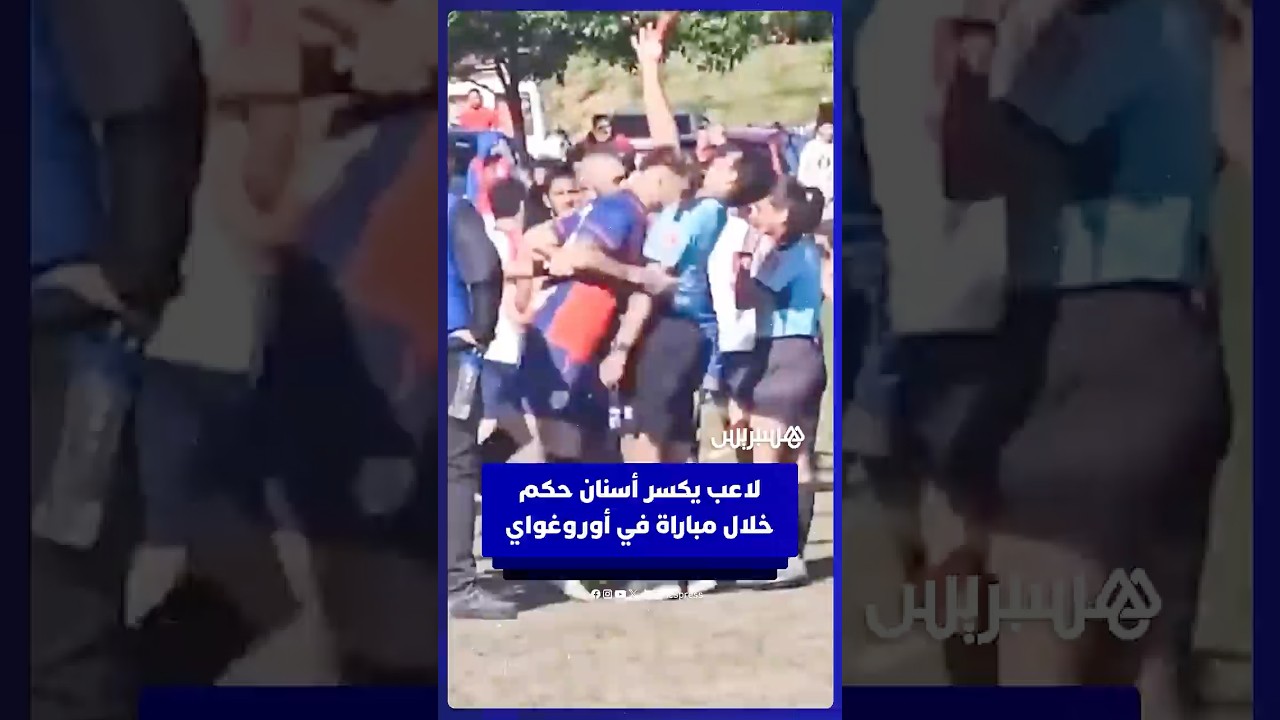 لاعب يكسر أسنان حكم بعد طرد زميليه خلال مباراة في أوروغواي thumbnail