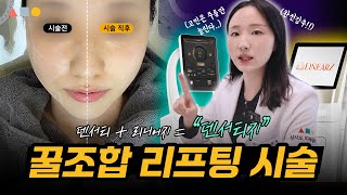 덴서티 리니어지 꿀조합인 이유 덴서티지 리프팅 꿀팁  _삼사오 피부클리닉