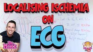 Localisaing Ischemia on an ECG