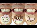 Satisfying Fujiya Anpanman 麵包超人 Chocolate Lollipop 5 Pack Box ASMR Japan Anpanman Chocolate