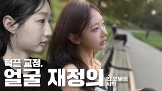 리;모델링 — 매부리·턱끝 정리하니 ‘얼굴 자체’가 바뀜 (수술 전 인터뷰)ㅣ비티성형외과