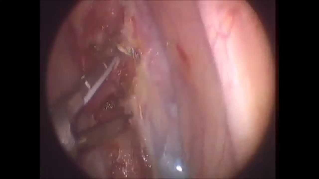 Willfredy Castaño Ruiz-28