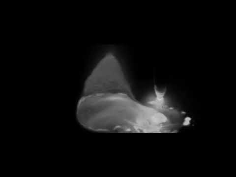 MeltView® SYNC high speed welding camera video of pulsed GMAW round corner