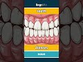 teeth - dientes video thumbnail