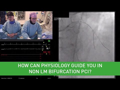 How can physiology guide you in non LM bifurcation PCI? - PCR Webinar